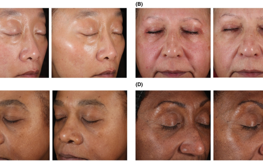 The Science Behind PQQ for Skin Improvement: Clinical Evidence and Practical Guidance